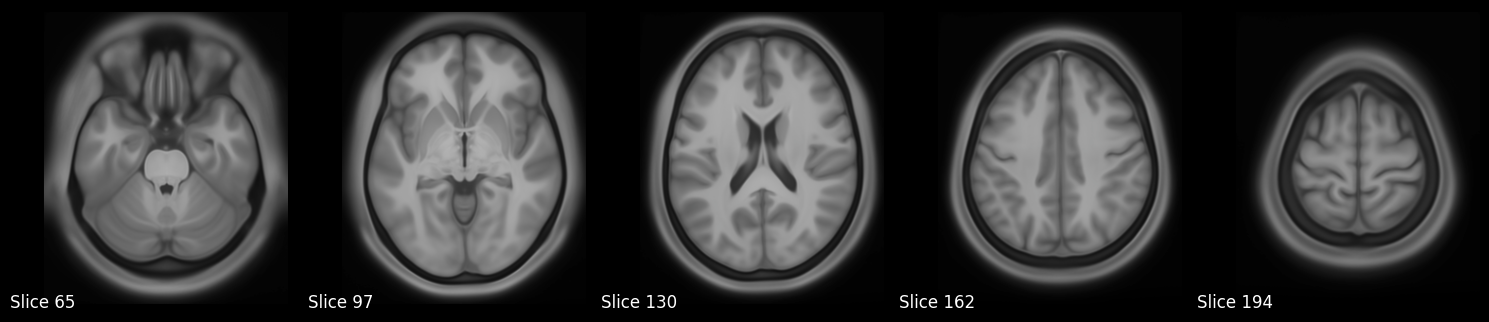 ../../_images/7822aa0d7e347c977955f5a084ee0126e66fe5a47994cd2c37ca9940eb2d63a4.png