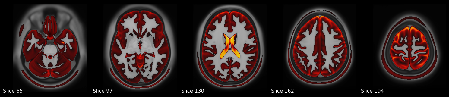 ../../_images/dde6f6a44441d08ac47d8f5db69c5459a478f0dc09feea678495a3d983fe8b9a.png
